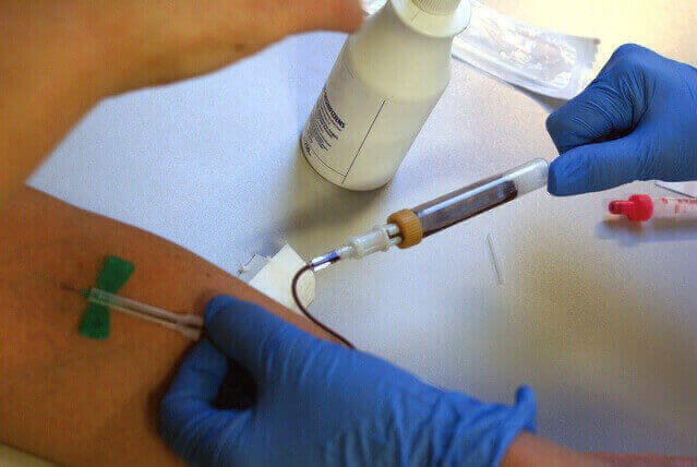 INR, PT test, Quick